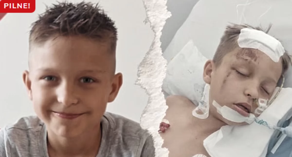Charytatywnie, Koszmarny wypadek Franek walczy powrót zdrowia! Pomóżmy - zdjęcie, fotografia