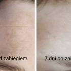 Fotka nr 1 z 4